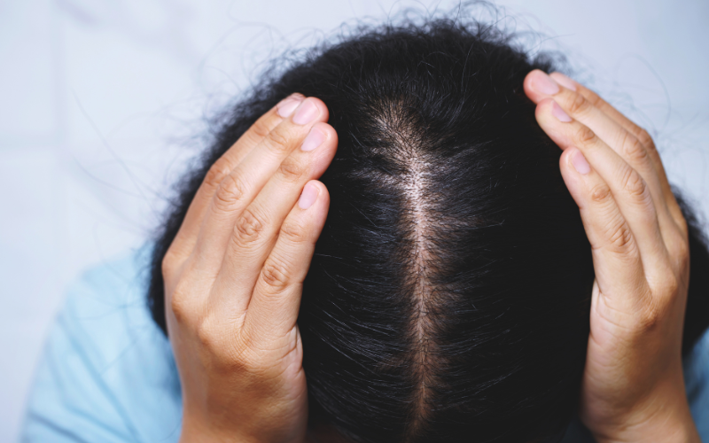 Los mejores consejos para prevenir el cabello dañado La importancia de la protección solar para el cabello