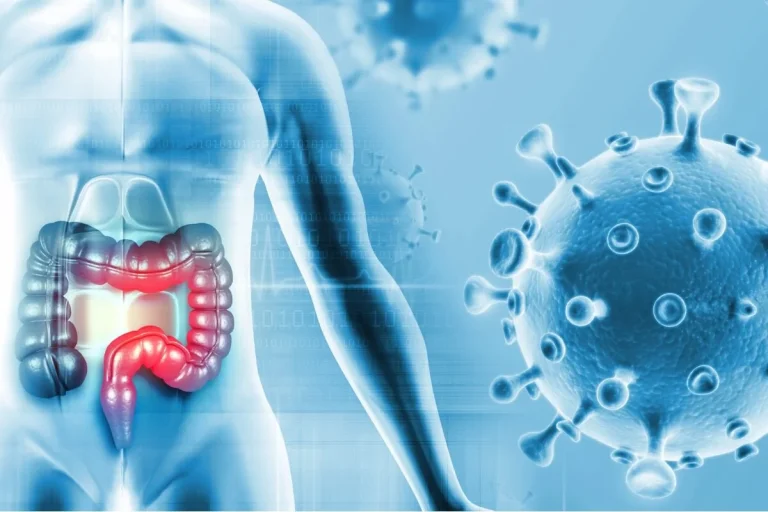 Microbioma Intestinal y su Rol en el Pronóstico del Cáncer de Colon